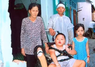 Bé trai bị u não đã mồ côi mẹ ảnh 1