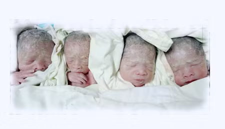 Ca sinh tư đầu tiên tại TP HCM.