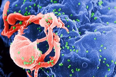 Virút HIV đang phát triển trên một tế bào bạch cầu.
