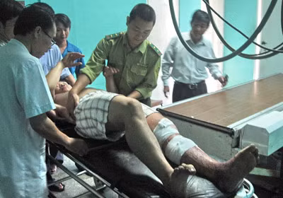 Anh Hoàng Văn Quế, được cấp cứu tại bệnh viện Việt Nam- Cuba Đồng Hới.
