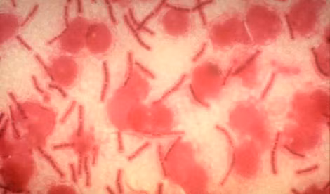 Virus bệnh than.