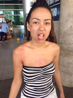 Ca sĩ Thảo Trang tả tơi sau khi bị cướp.