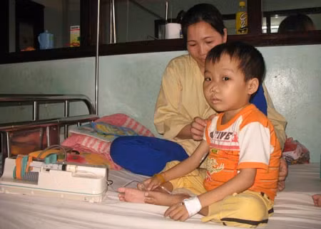 Dù đã 8 tuổi nhưng vì bị Thalassemia mà bé Luân còi cọc như đứa trẻ lên 4 với gương mặt đã bị biến dạng.