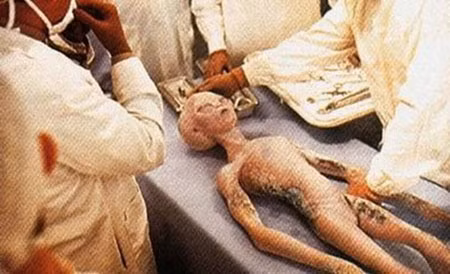Khám nghiệm thi thể được cho là một người ngoài hành tinh bị rơi ở Roswell.