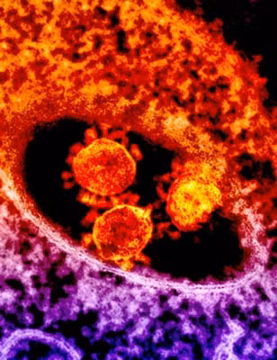 MERS được phát hiện tại Arập Xêút năm 2012.