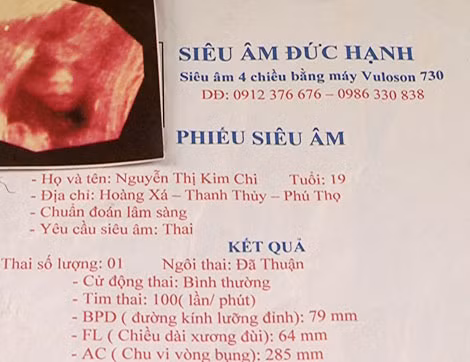 Tờ kết quả siêu âm được làm giả.