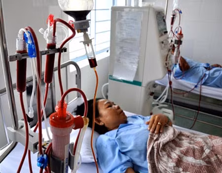 Chạy thận nhân tạo vì suy thận.