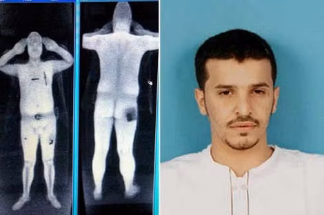 Chất nổ cấy trong cơ thể của "tác giả" Al-Asiri.