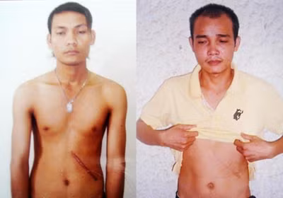Vàng và Truyền vừa là bị hại vừa là bị can trong vụ bán thận xuyên quốc gia.