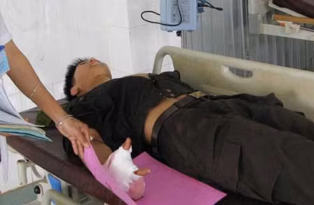 Một chiến sỹ Công an bị thương trong vụ gây rối ngày 20/4/2011.