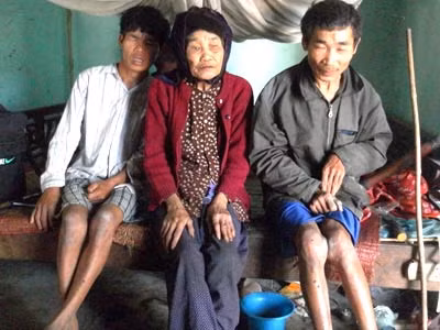 Bà Cự và hai người con tật nguyền. Bữa ăn đạm bạc của bà Cự cùng các con.