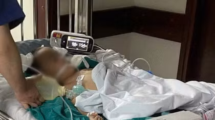 Bé trai nguy kịch sau thời gian gửi tại cơ sở can thiệp trẻ