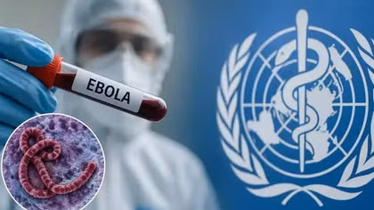 Bộ Y tế khuyến cáo người dân hạn chế đến vùng dịch Ebola 