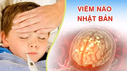 Xuất hiện các ca viêm não Nhật Bản, cảnh báo biến chứng nghiêm trọng