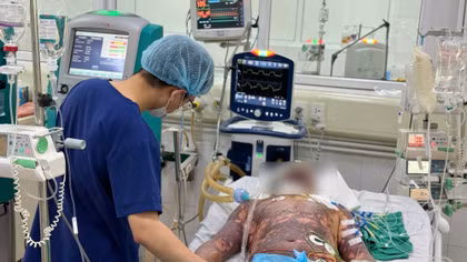 4 người nhập viện vì liên cầu lợn, có bệnh nhân nguy kịch