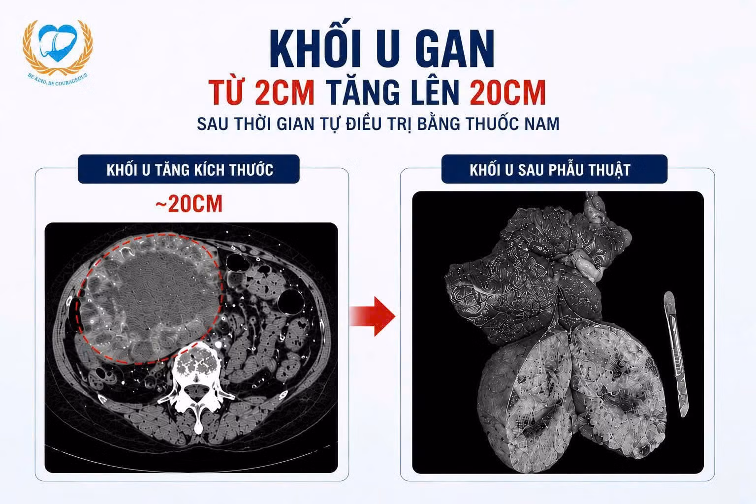 u-gan.jpg