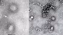 Australia đạt đột phá, kì vọng sắp có vaccine chống virus corona