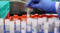 Phát hiện biến chủng COVID-19 ở Anh có thể kháng vaccine