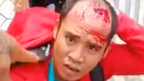 Chủ hiệu vàng mưu trí giả ngất tóm gọn tên cướp manh động