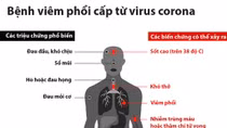 Bình Dương họp khẩn ứng phó virus Corona