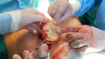 Cơ sở thẩm mỹ “chui” ngang nhiên hoạt động
