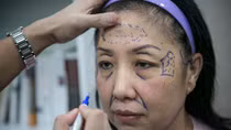 Nở rộ dịch vụ phẫu thuật thẩm mỹ: Làm đẹp cũng cần tỉnh táo