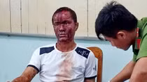 Nỗi lo thảm án do người bệnh tâm thần gây ra