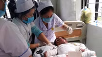 Đổ đèn dầu trong lúc mắc màn, 2 mẹ con bỏng nặng