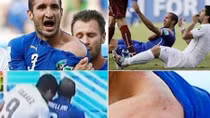 Suarez bị nhắc nhở "đừng cắn tại World Cup"