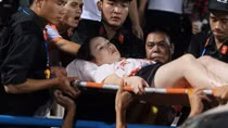 Nữ CĐV bị thương vì pháo sáng trên sân Hàng Đẫy
