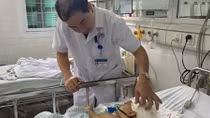 Lần đầu tiên phẫu thuật thành công trường hợp em bé bị dị dạng hộp sọ hiếm gặp