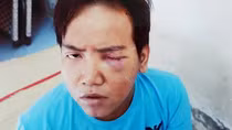 Thảm kịch người tâm thần gây án