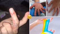 Cảnh giác với "chất nhờn ma quái"