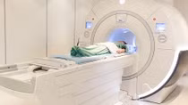 Đột quỵ não và vai trò của chụp cộng hưởng từ (MRI) trong tầm soát đột quỵ