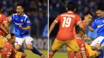 Hải Huy báo tin mừng sau chấn thương kinh hoàng tại vòng 3 V.league