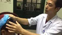 Phẫu thuật cứu cháu bé bị bệnh... tự nhiên cười