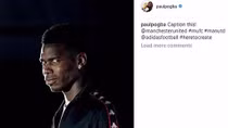 Nghịch lý Pogba 