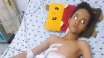 Hãy giúp đỡ thiếu niên 13 tuổi bị thanh sắt đâm xuyên ngực bụng