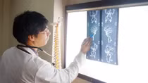 Mở hộp sọ, giành lại sự sống cho bệnh nhân bị phình động mạch não 