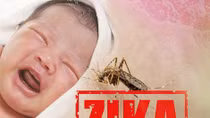 Chống virus Zika: Chạy đua với thời gian