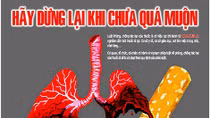 Xây dựng đơn vị không thuốc lá trong CAND