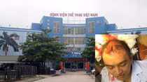 Bác sĩ bị tấn công nhìn từ nhiều phía