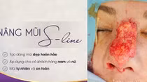 Cái kết cực đắng cho việc làm đẹp không đúng cách