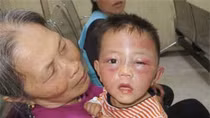 Cháu bé 2 tuổi bị bố dượng đánh đập tàn nhẫn