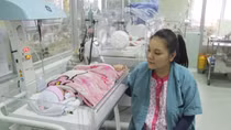Ca phẫu thuật nghẹt thở cứu bé trai bị 4 vòng dây rốn quấn cổ 