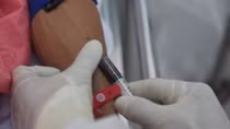 Thêm bệnh viện được cho phép xét nghiệm chủng mới của virus Corona 