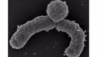 Teixobactin, chất kháng sinh từ bụi đất chống lại siêu vi khuẩn