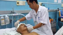 Phẫu thuật thành công bệnh nhân có túi phình động mạch não
