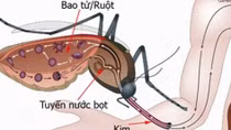 Bệnh sốt rét tăng cao