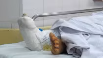 Nạn nhân vào Bệnh viện Việt Đức đã được phẫu thuật kịp thời